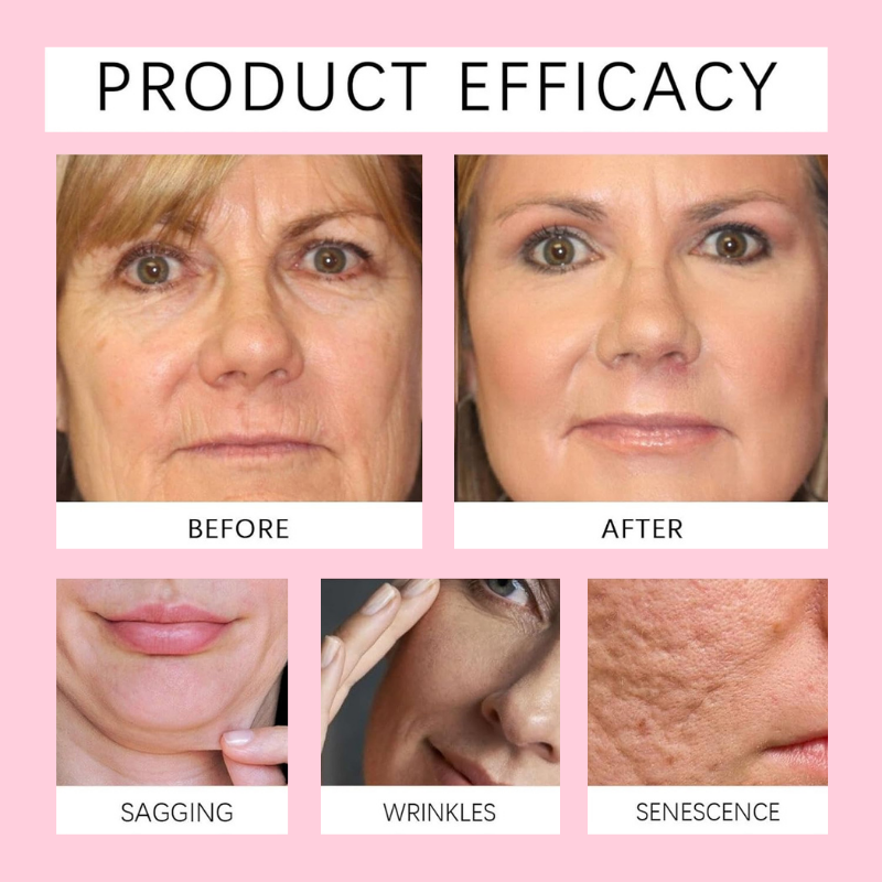 Hoygi™ | Korean Overnight Mask